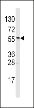 ALDH6A1 Antibody (N-term)