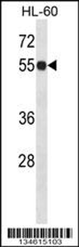 IMPDH1 Antibody (N-term)