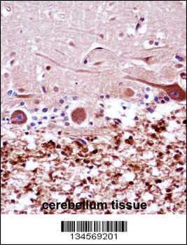 FANCG Antibody (C-term)