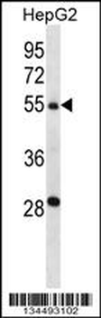 TMPRSS13 Antibody (C-term)