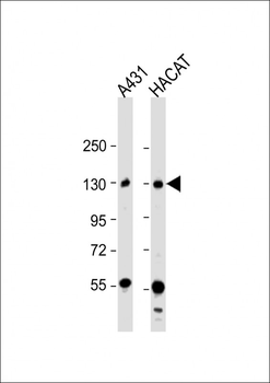 DSG3 Antibody (N-term)
