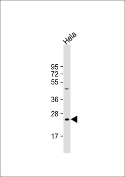 HMGB3 Antibody (Center)