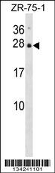 IL25 Antibody (Center)