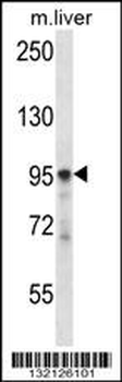 PLCD3 Antibody (N-term)