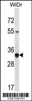 OR2W5 Antibody (C-term)