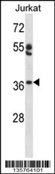 OVOL1 Antibody (N-term)