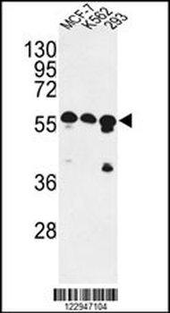 CNOT4 Antibody