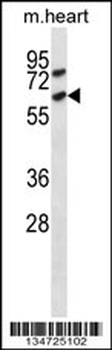Mouse Acvr1c Antibody (C-term)