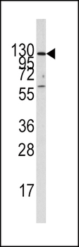 IDE Antibody (Center)