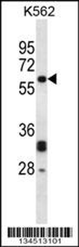 NMT2 Antibody (C-term)