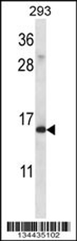 RPS19 Antibody (C-term)