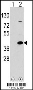 EPM2A Antibody (C-term)