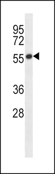 GABRB2 Antibody (C-term)