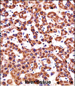 CYP2D6 Antibody (N-term)
