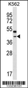 OR6Q1 Antibody (C-term)