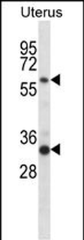FAM172A Antibody (Center)