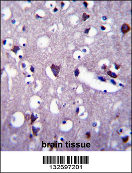 CNGA2 Antibody (N-term)