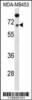 TDT Antibody (N-term)