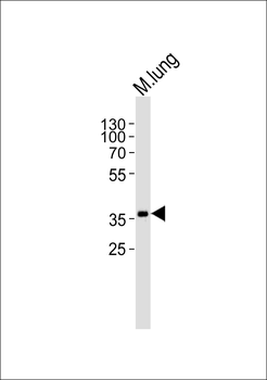 Mouse Hoxa1 Antibody (Center)