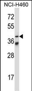 Mouse Mapkapk5 Antibody (N-term)