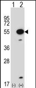 Mouse Mapkapk5 Antibody (N-term)