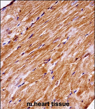 Mouse Map4k3 Antibody (Center)