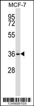 Mouse Map2k3 Antibody (Center)