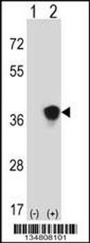 Mouse Map2k3 Antibody (Center)