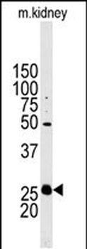 Stanniocalcin-2 (STC2) Antibody (N-term)