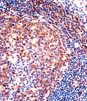 PTGIR Antibody (Center)