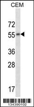 CHRM2 Antibody (Center)
