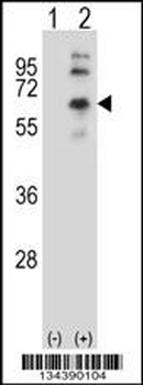 CHRM2 Antibody (Center)