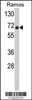 POTE Antibody (C-term)