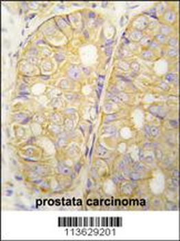 POTE Antibody (C-term)