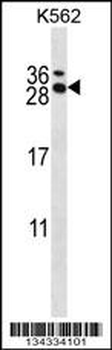 RCAN3 Antibody (C-term)