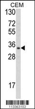 DPPA4 Antibody (N-term)