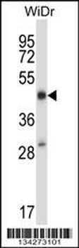 STEAP1 Antibody (N-term)