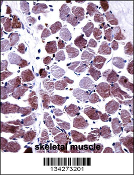STEAP1 Antibody (N-term)