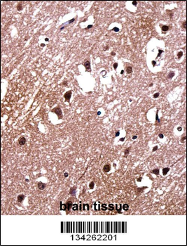 LDB2 Antibody (C-term)