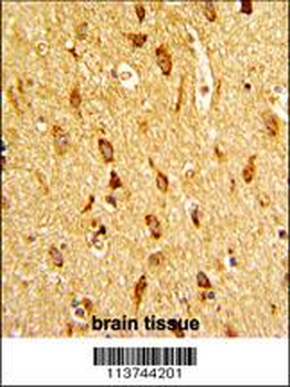 H Cadherin (CDH13) Antibody (N-term)