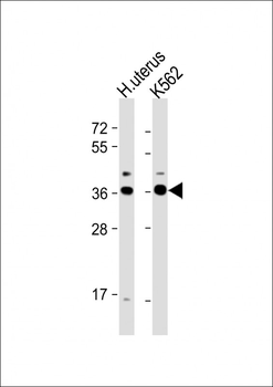 OR52H1 Antibody (C-term)