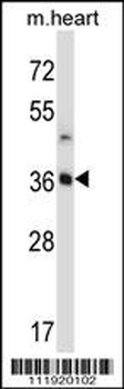STC2 Antibody (C-term)