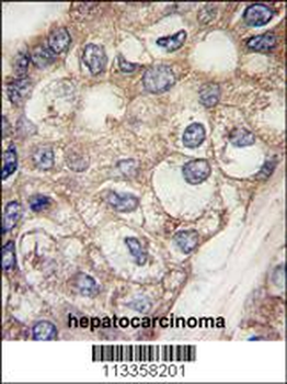 AFP Antibody (Center)