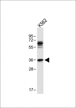 PITX2 Antibody (C-term)