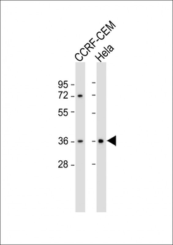 PITX2 Antibody (C-term)