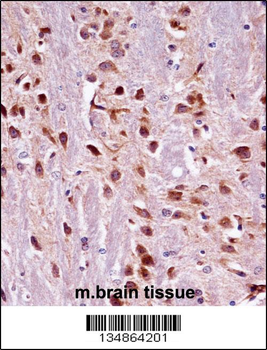 Mouse Prkca Antibody (N-term)