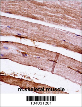 Mouse Mapkapk3 Antibody (N-term)