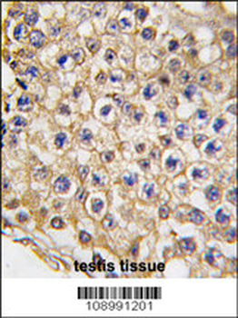 Mouse TRPV3 Antibody (N-term)