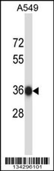 NAPB Antibody (N-term)