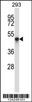 TOM1L1 Antibody (C-term)
